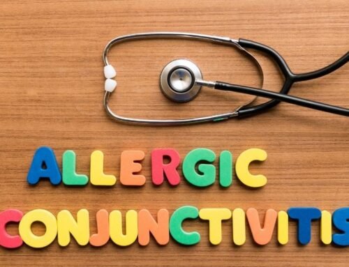 Allergic Conjunctivitis