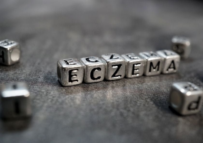 Eczema in Children