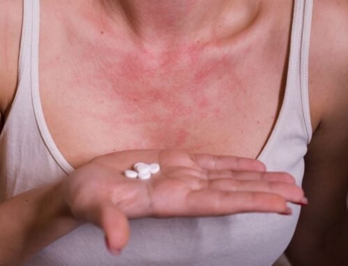 Какие препараты вызывают лекарственную аллергию?