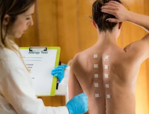 At Which Age Do an Allergy Test